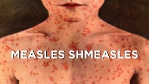 measles