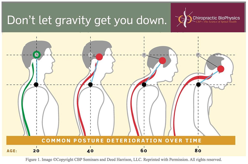 chiropractor-austin-tx-poor-posture