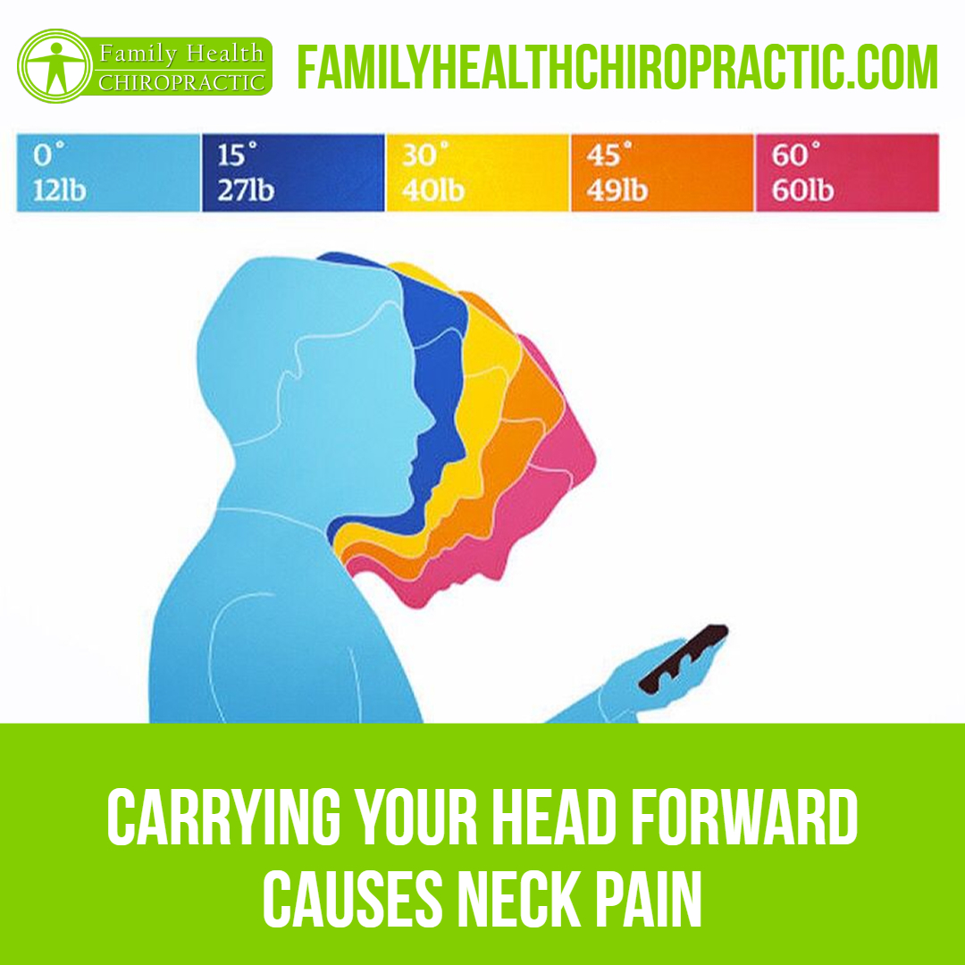 forward head posture neck pain